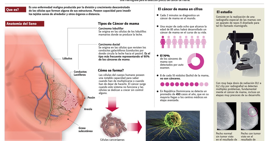 Porque pierde peso un enfermo de cáncer